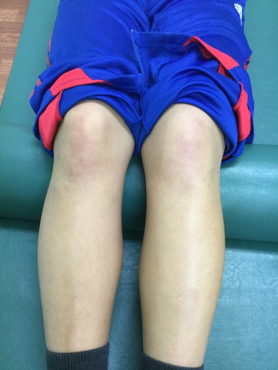 沖縄小禄田原骨折脱臼捻挫怪我
