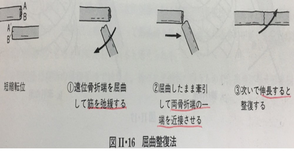 沖縄那覇小禄田原骨折脱臼捻挫怪我